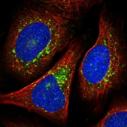 VTI1B Antibody, Novus Biologicals 25 &mu;L, Unlabeled:Antibodies, Polyclonal